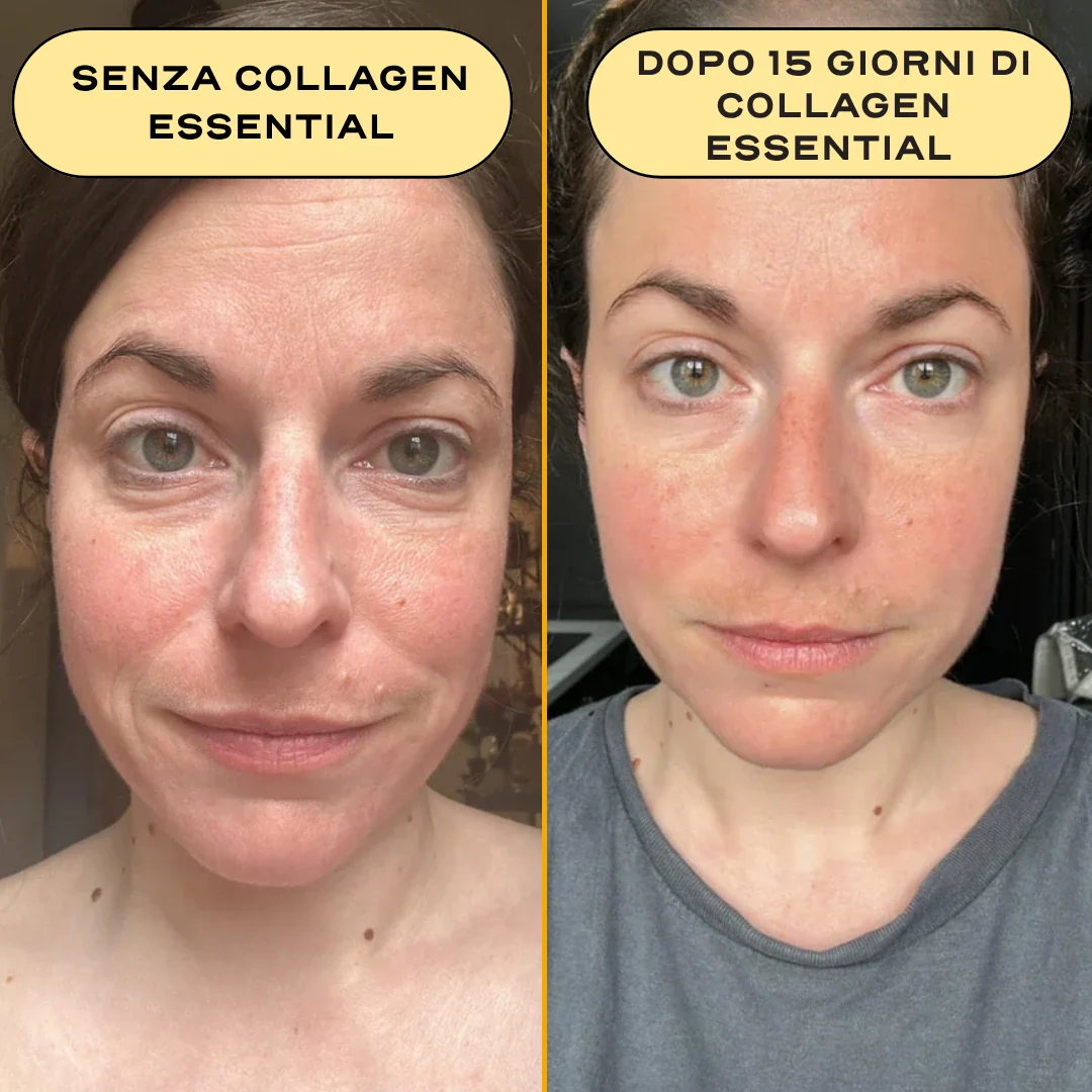 COLLAGEN ESSENTIAL. - Image 7