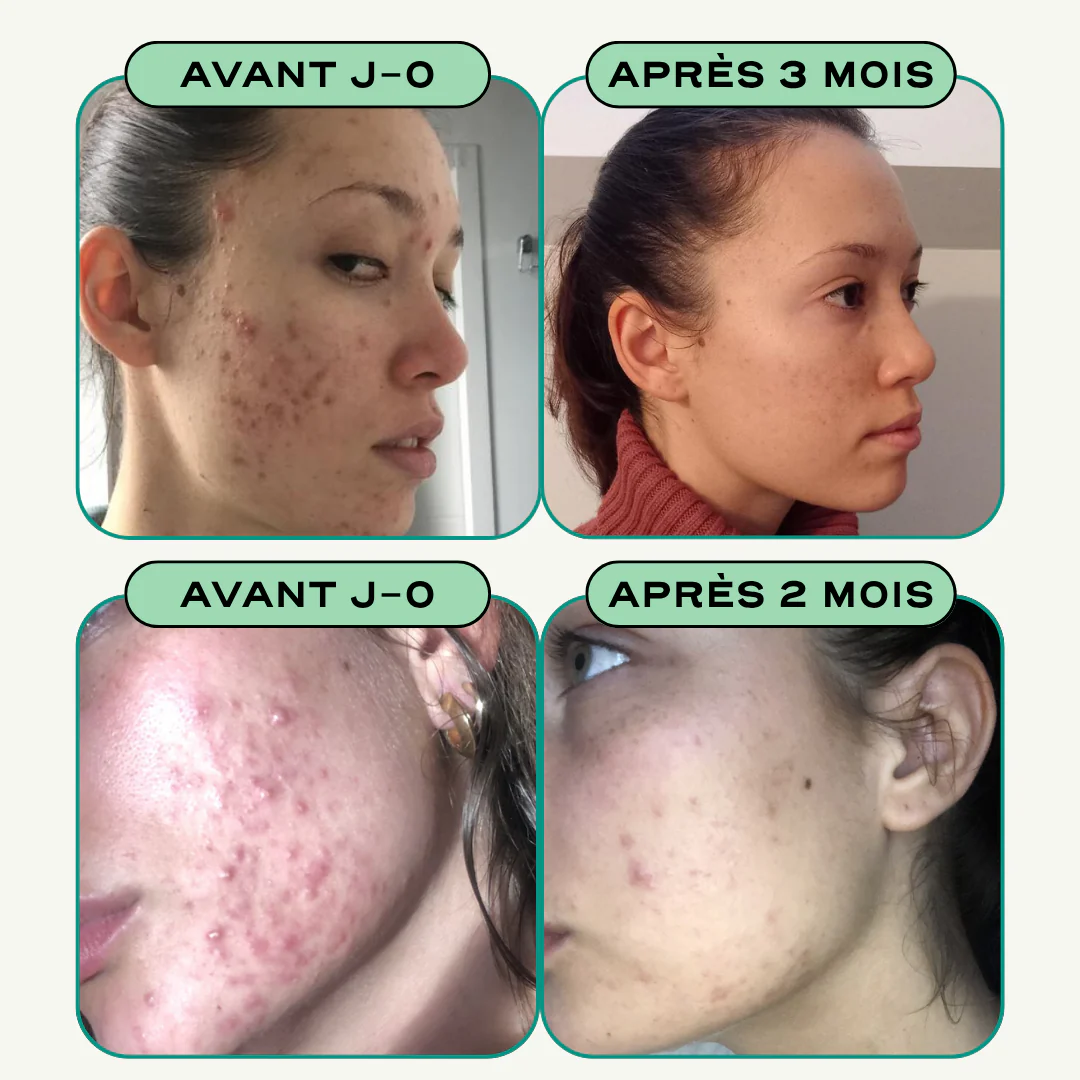 Duo Équilibre Peau & Digestion - Image 6