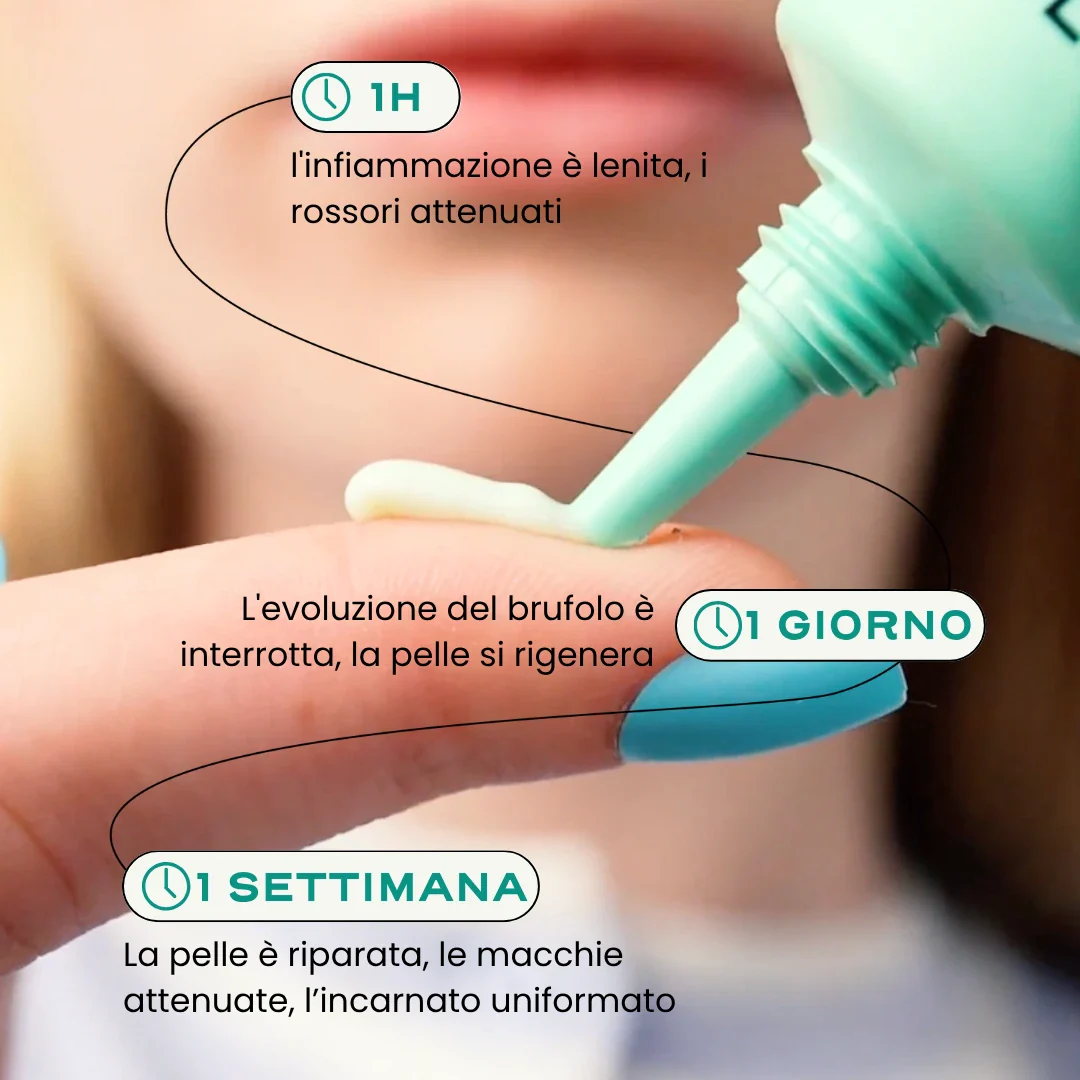 SOS Acne "In & Out". - Image 12