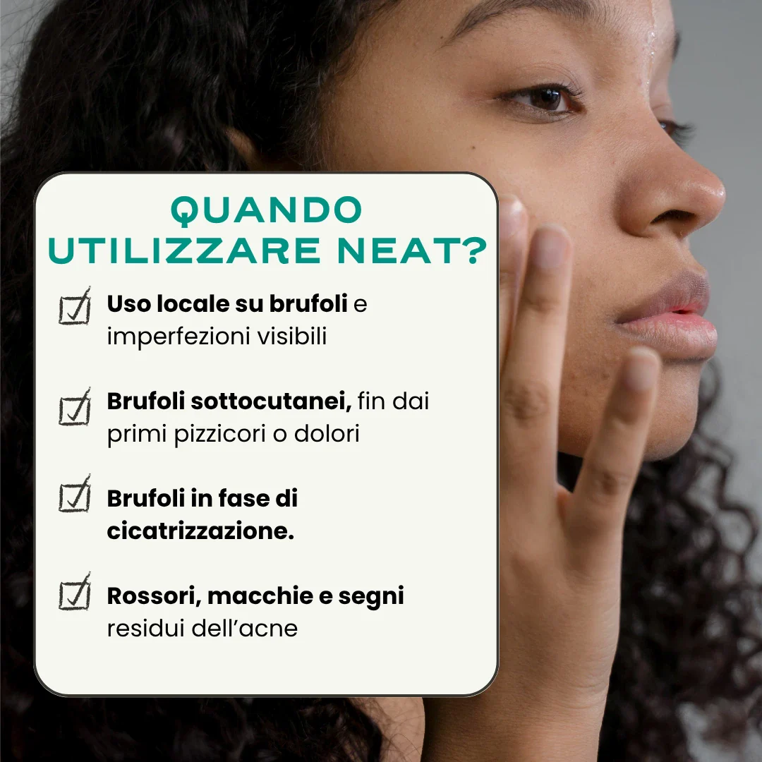 SOS Acne "Out". - Image 9