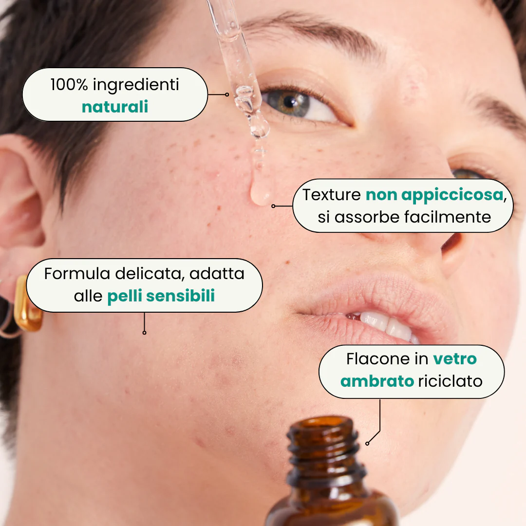 SOS Acne "Out". - Image 15