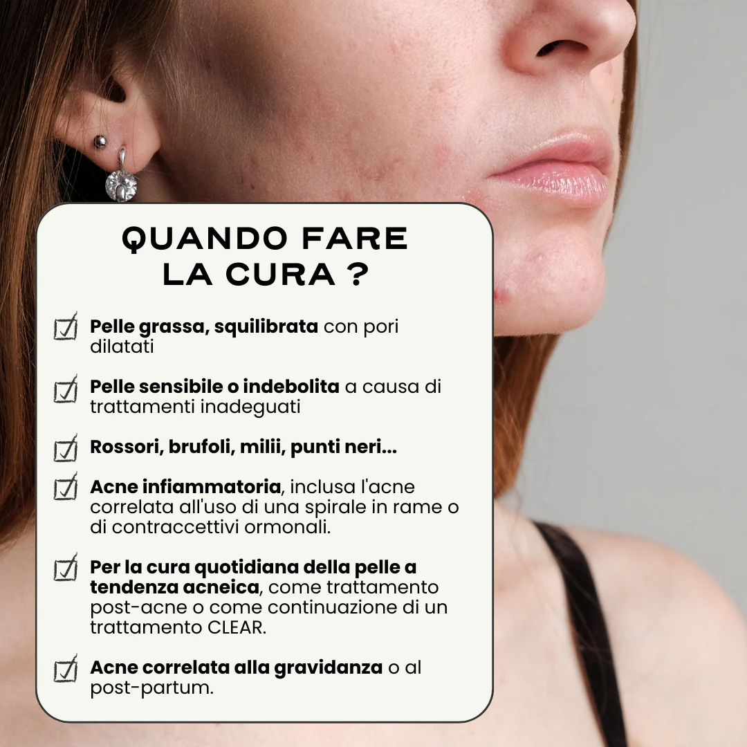 Routine Acne Completa "Out". - Image 3