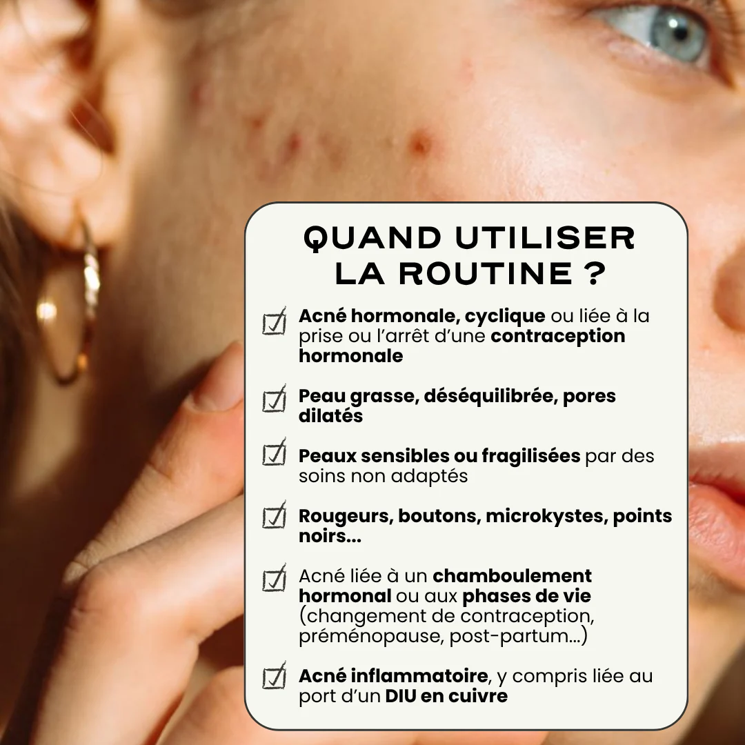 Routine Acné Complète "In & Out" - Image 3