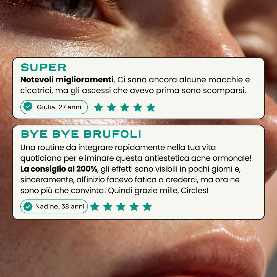 Routine Acne Universale. - Image 6