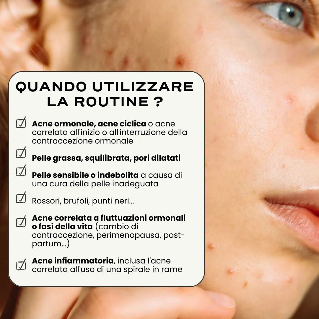 Routine Acne Universale. - Image 8