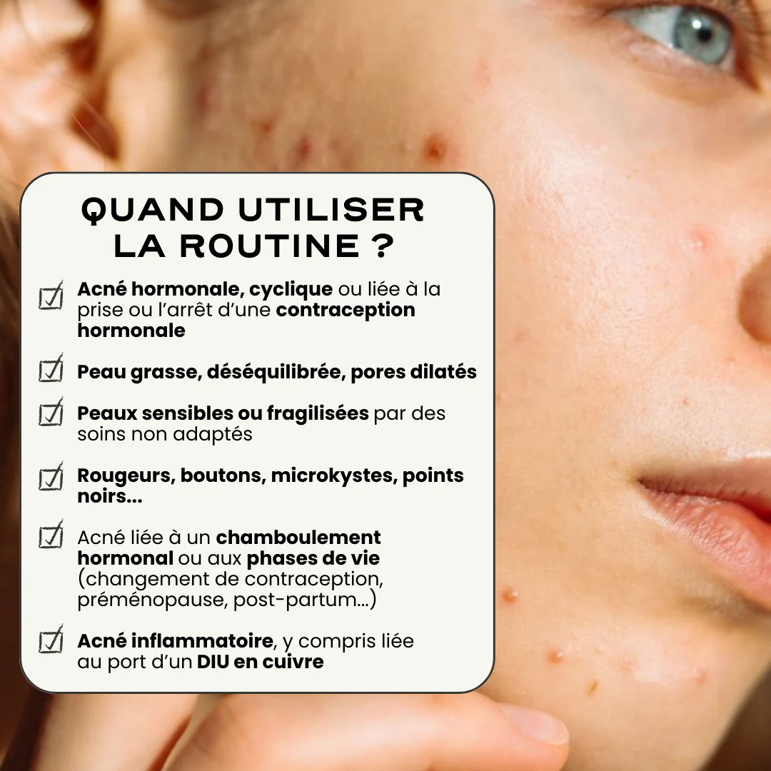 Routine Acné Universelle - Image 3