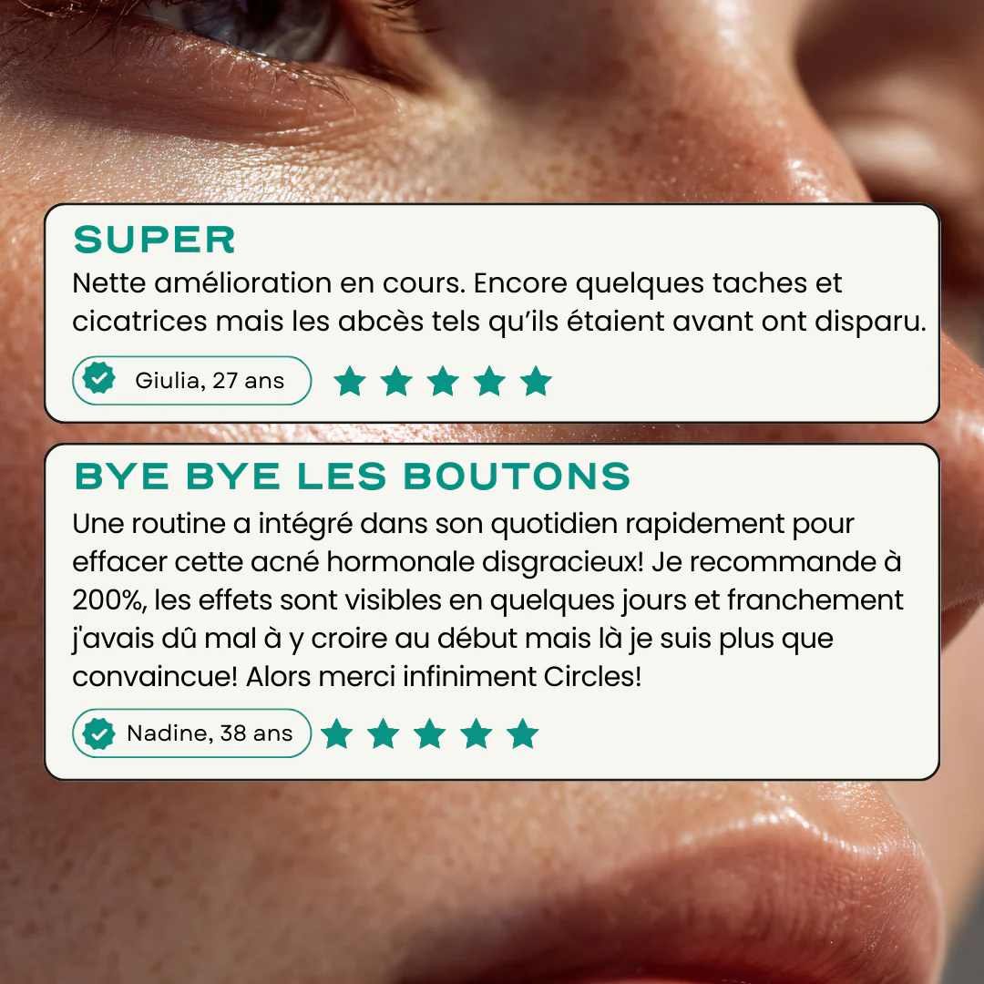 Routine Acné Universelle - Image 4