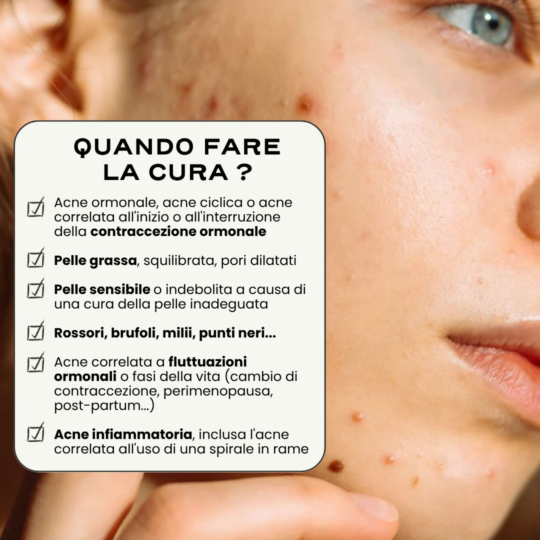 SOS Acne "In & Out". - Image 6