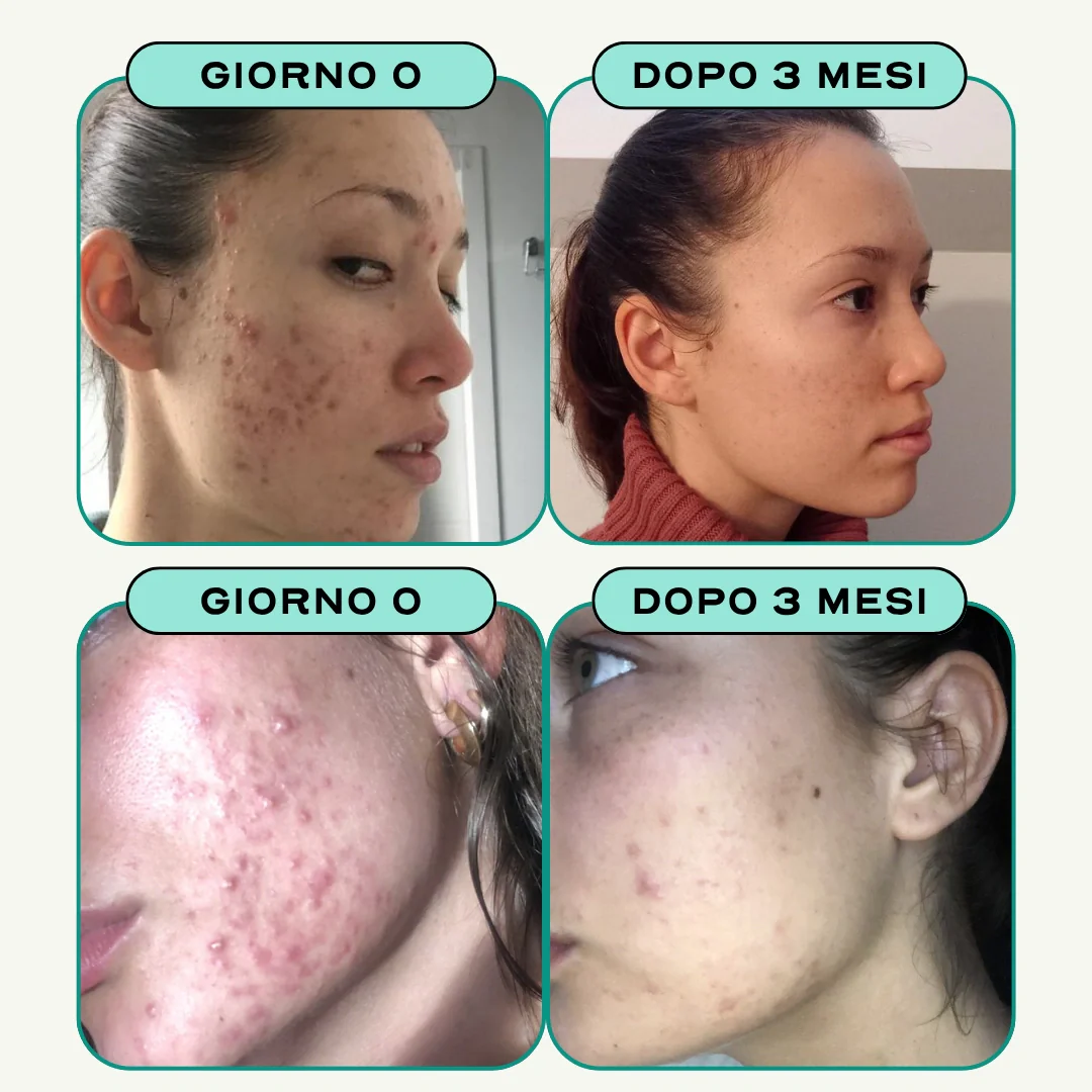 Duo Riequilibrio & Detox. - Image 9